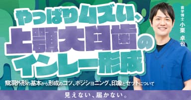 やっぱりムズい、上顎大臼歯のインレー形成