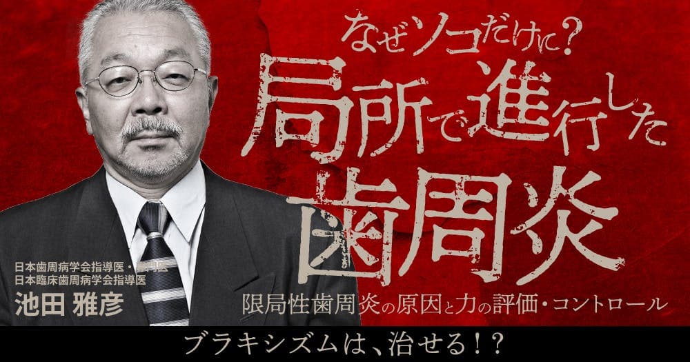 なぜソコだけに？局所で進行した歯周炎