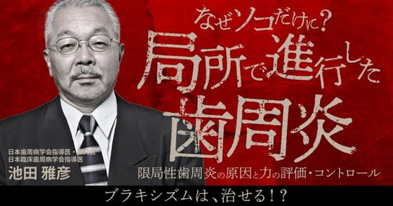 なぜソコだけに？局所で進行した歯周炎