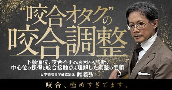”咬合オタク”の咬合調整