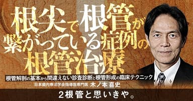 根尖で根管が繋がっている症例の根管治療