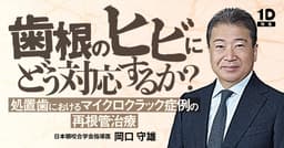 「歯根のヒビ」にどう対応するか？
