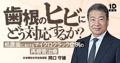 「歯根のヒビ」にどう対応するか？
