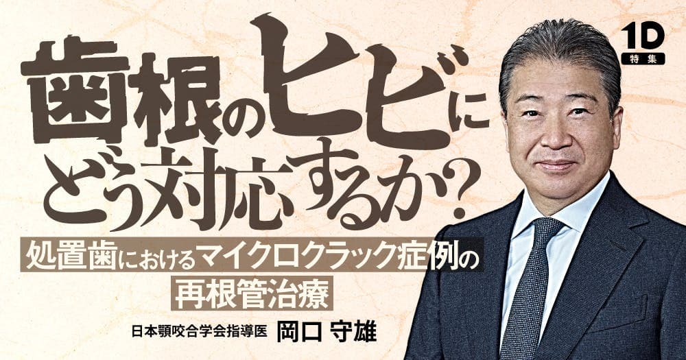 「歯根のヒビ」にどう対応するか？