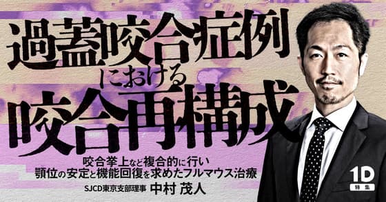 過蓋咬合症例における咬合再構成