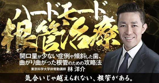 ハードモード根管治療