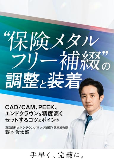 ランキング6位の”保険メタルフリー補綴”の調整と装着