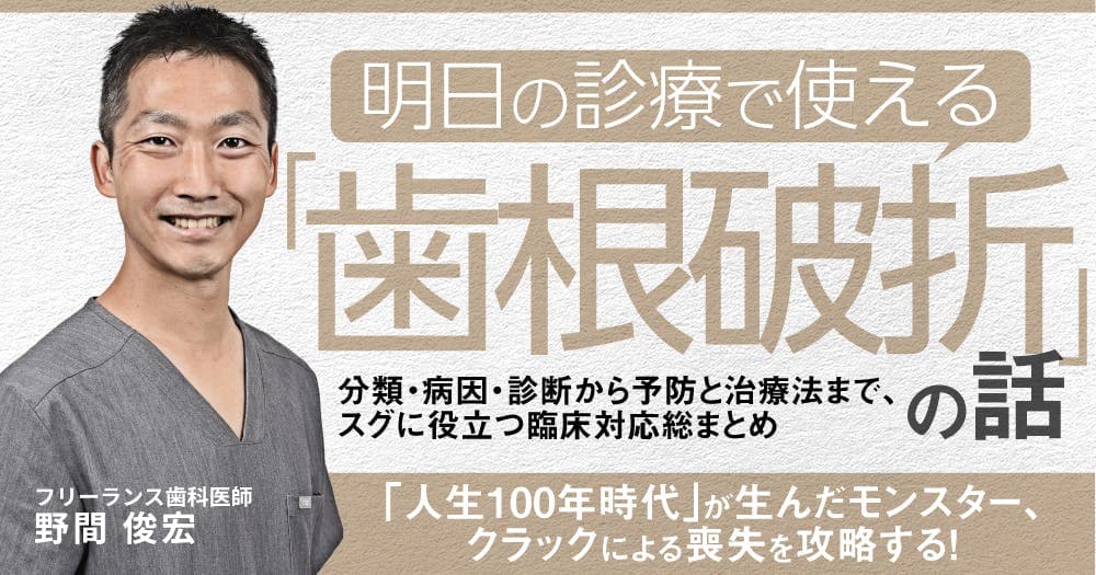 明日の診療で使える「歯根破折」の話 - 分類・病因・診断から予防と治療法まで、スグに役立つ臨床対応総まとめ