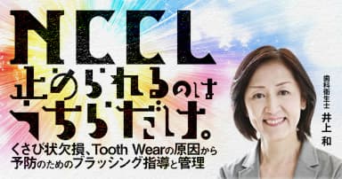 NCCL止められるのはうちらだけ。