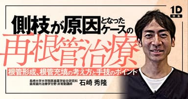 側枝が原因となったケースの再根管治療