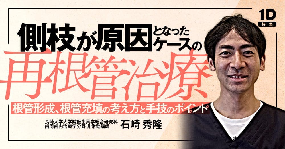 側枝が原因となったケースの再根管治療
