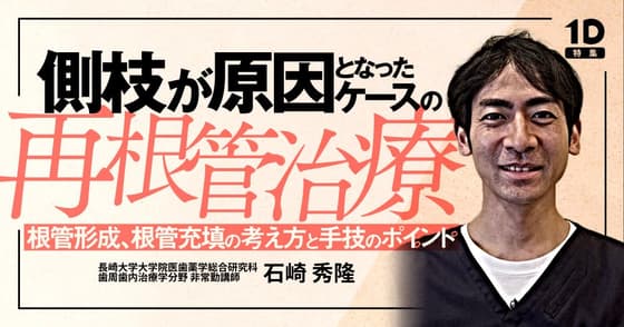 側枝が原因となったケースの再根管治療