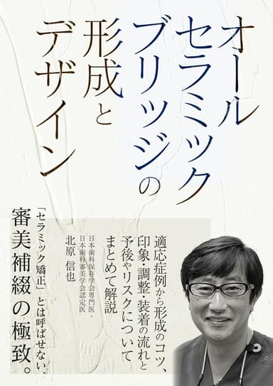 ランキング16位のオールセラミックブリッジの形成とデザイン