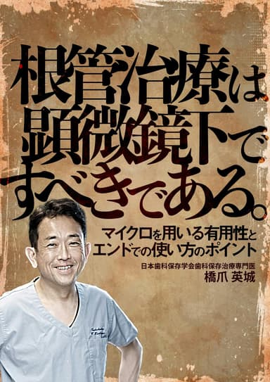 ランキング5位の根管治療は顕微鏡下ですべきである。
