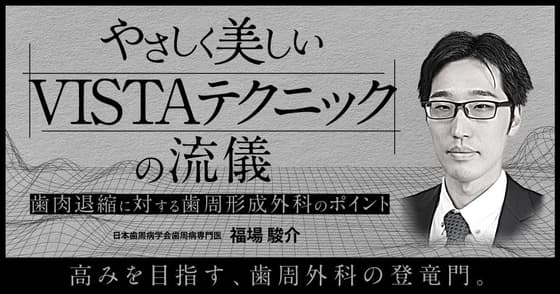やさしく美しいVISTAテクニックの流儀
