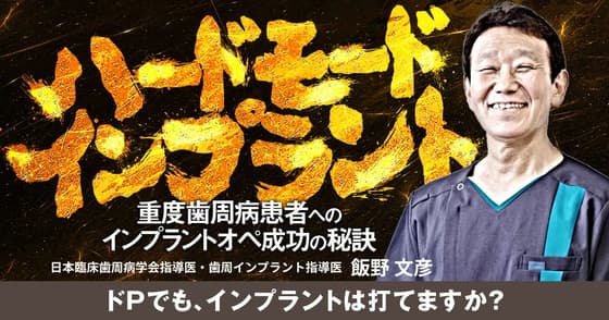 ハードモードインプラント