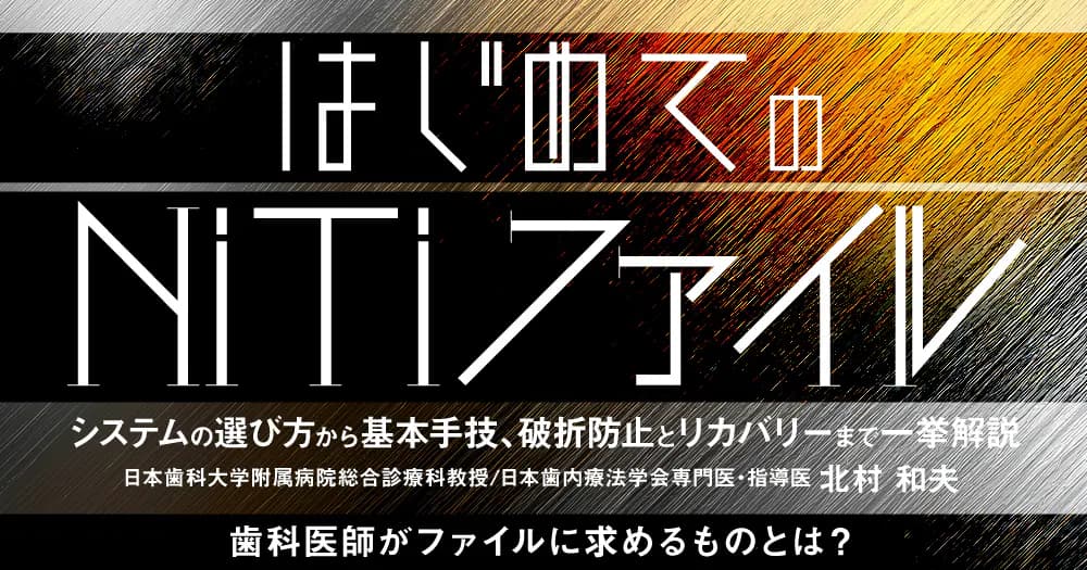 はじめての「NiTiファイル」