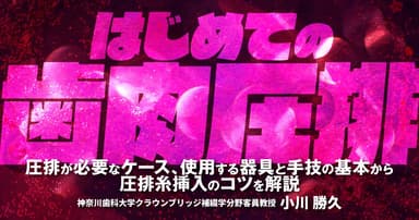 はじめての「歯肉圧排」