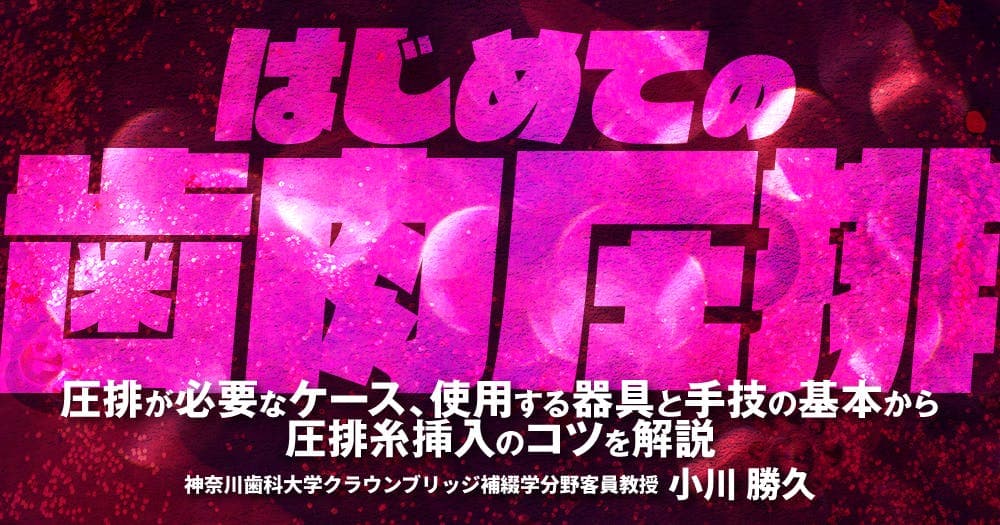 はじめての「歯肉圧排」