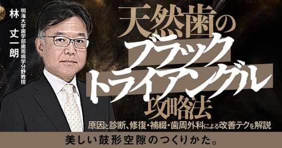 天然歯のブラックトライアングル攻略法