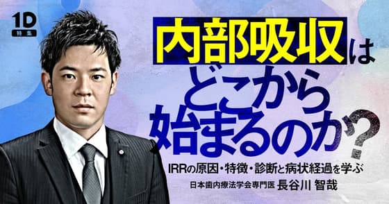 内部吸収はどこから始まるのか？