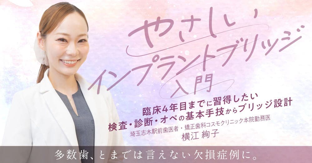 やさしい「インプラントブリッジ」入門 - 臨床4年目までに習得したい検査・診断・オペの基本手技からブリッジ設計