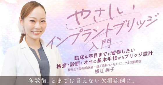 やさしい「インプラントブリッジ」入門