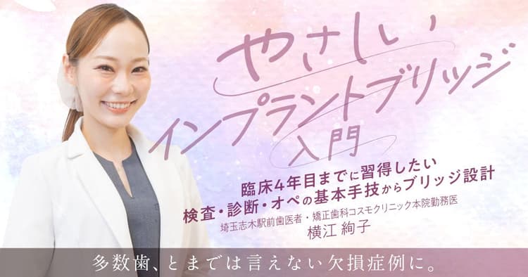 やさしい「インプラントブリッジ」入門