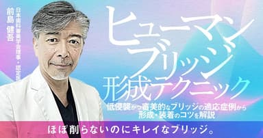 「ヒューマンブリッジ」形成テクニック