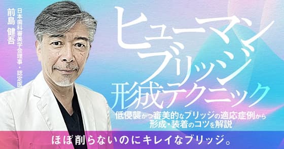 「ヒューマンブリッジ」形成テクニック