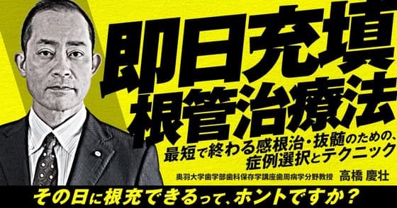 即日充填根管治療法