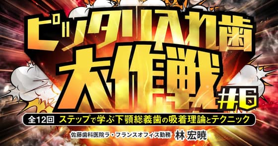 ピッタリ入れ歯大作戦#6