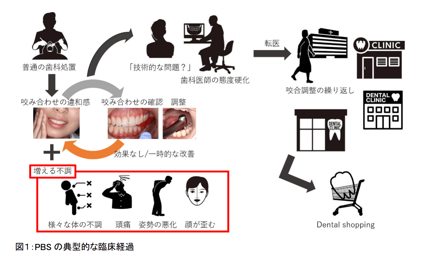 「咬合に違和感」患者は 