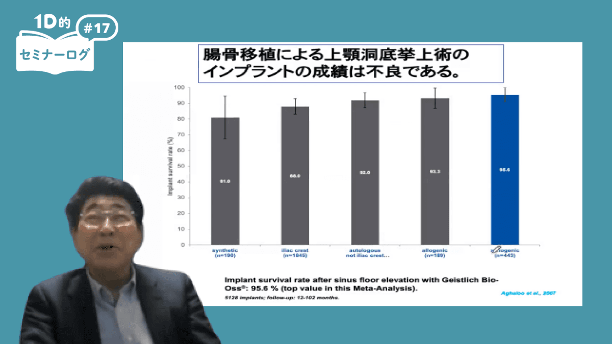 1D的セミナーログ】サイナスリフトの基礎知識と起こり得る偶発症｜1D