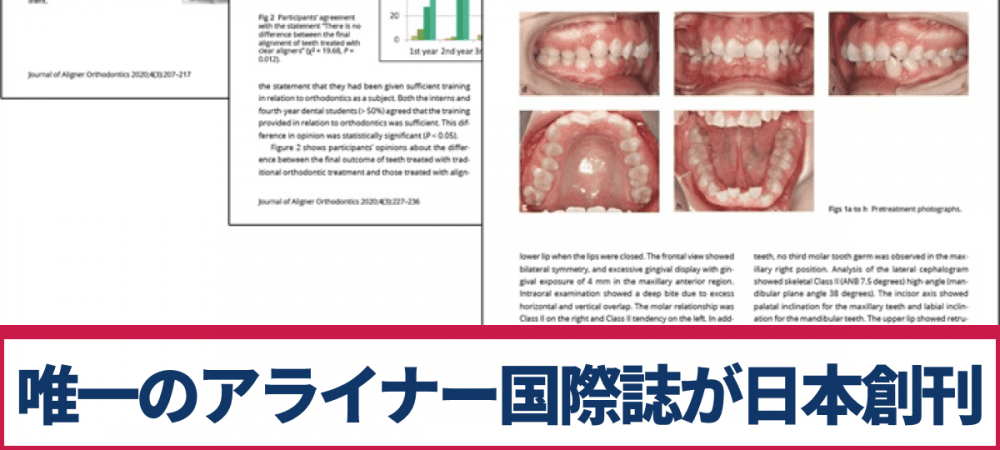 唯一のアライナー国際誌、日本でも今冬創刊へ｜1D（ワンディー）