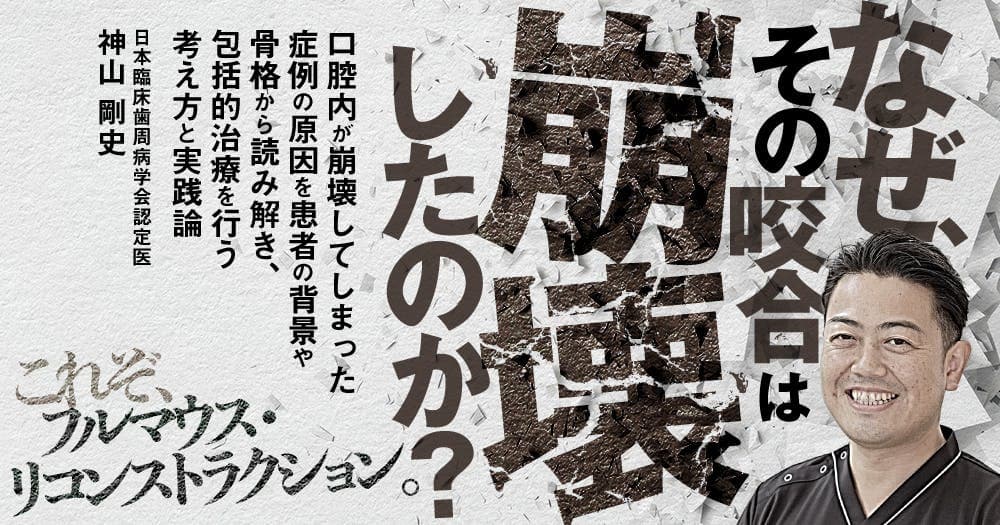 なぜ、その咬合は崩壊したのか?