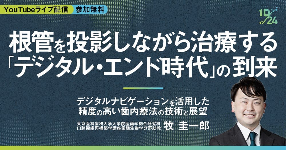 根管を投影しながら治療する「デジタル・エンド時代」の到来 - デジタルナビゲーションを活用した精度の高い歯内療法の技術と展望