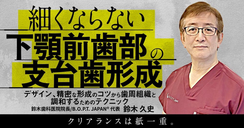 細くならない「下顎前歯部の支台歯形成」 - デザイン、精密な形成のコツから歯周組織と調和するためのテクニック