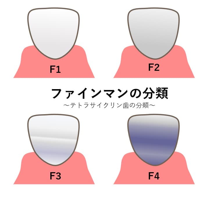 ファインマンの分類の画像